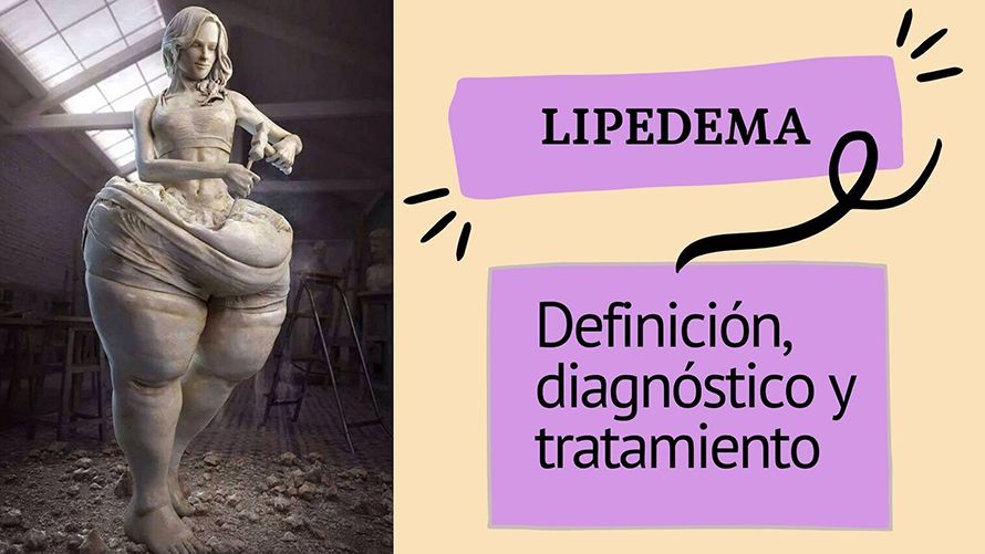 lipedema