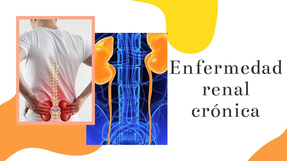 dieta para la enfermedad renal